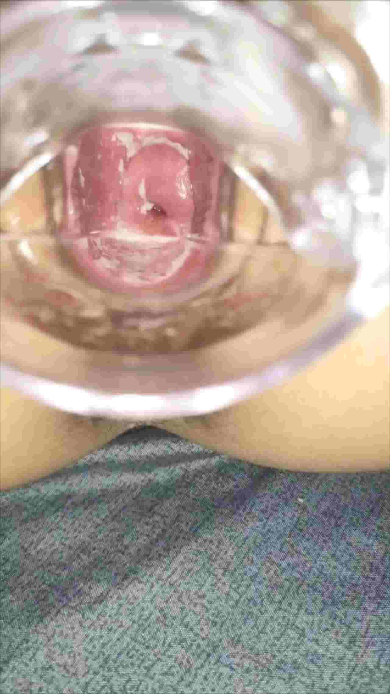  超级可爱的 清纯大学校花 用扩阴器插里面，近距离看小穴里面 的剧照3